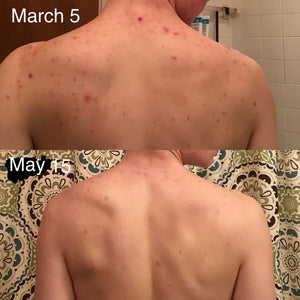 b-a-my-first-before-after-thank-you-sca-for-helping-me-v0-hy3sevupnfy01.webp
